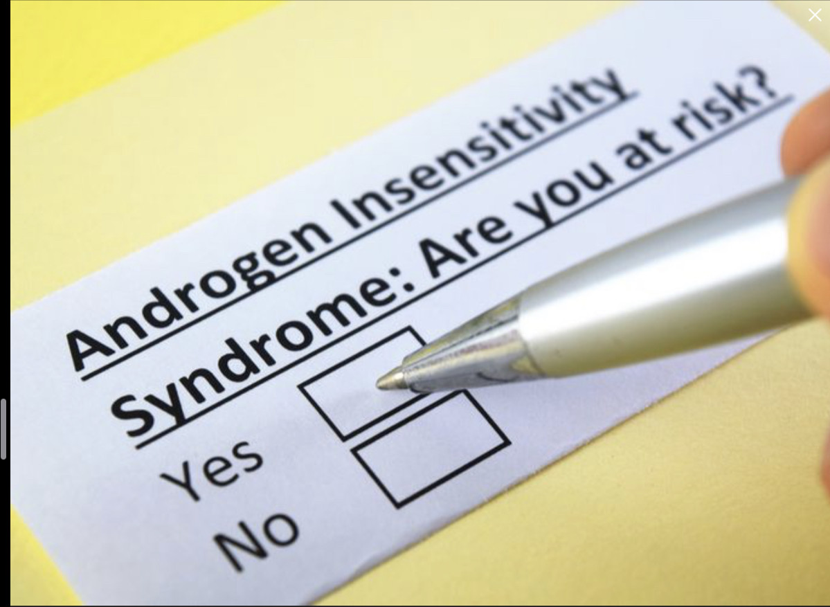 Sindrom Insensitivitas Androgen